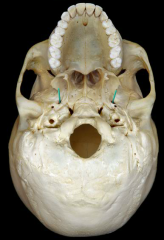 The foramen ovale (where the mandibular branch exits).
