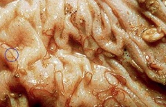 These worms were found inside a sheep that died after showing signs of anaemia & weakness. Dx?
