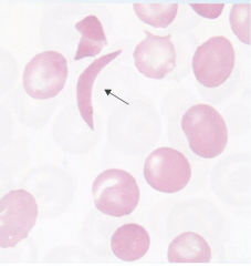 Describe the RBC shape of the cells.