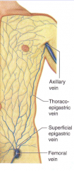 femoral vein from leg, superficial epigastric vein, thoracoepigastric vein up to axillary vein