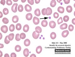 Describe the platelet morphology indicated here