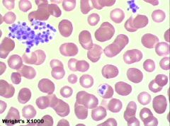 Describe the platelet morphology indicated here