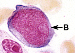 Large nucleus with lacy chromatin and Nucleoli.  Prominent Nucleolus