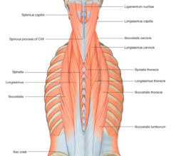 One of the lumbar epaxial muscles. The boundaries are the  last rib, to iliac crest and dorsal spinal processes to lateral tip of transverse process.