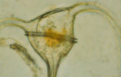 Top half of a phytoplankton.