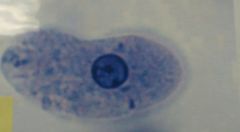 What larger protozoan group does this protozoa belong to?