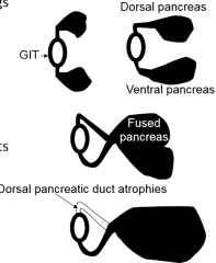 1. 2 Outpockets of endoderm form dorsal and ventral pancreas2. The two fuse with each other3. Dorsal pancreatic duct degrades