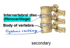 Secondary cartilaginous joints are found within the midline. They are comprised of a wedge of fibrocartilage between layers of hyaline cartilage. Example is the intervertebral discs
