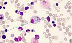 Giemsa or Wright’s stains: Look for small, round to oval yeast cells within mononuclear cells (intracellular)