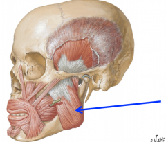 Superiomedial fibers from the lateral surface of ramus of the mandible to zygomatic arch (mostly verticle going down to the mandibular angle)