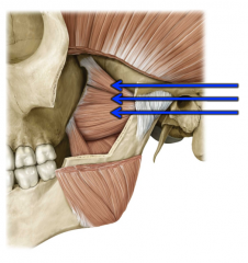 Horizontal fibers from the condylar process of the mandible to the lateral pterygoid plate of the sphenoid bone