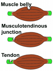 1. Muscle Belly2. Musculotendinous Junction3. Tendon
