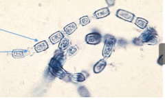 Hyaline, septate hyphae
Conidiophores absent
Arthroconidia unicellular, rectangular to barrel shaped, often somewhat wider in diameter than the hyphae, alternating with empty cells (disjunctors)