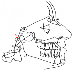 Midpoint of the upper contour of the external auditory meatus