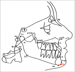 The center of the inferior contour of the chin