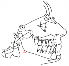 The center of 
the inferior 
contour of the 
mandibular angle.