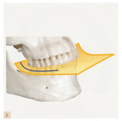 The anterior-posterior curve from the cusp tip of the mandibular canine following through the cusp tips of the posterior teeth