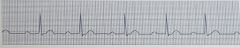 Identify the ECG rhythmRate: NormalRhythm: NormalQRS: <0.10 secP Waves: Normal in size and configurationPR Int: Prolonged (>0.20 sec), but constantDescription: Normal rate&rhythm. Long PR interval. 