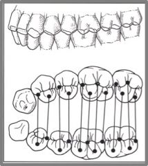NEUTRAL OCCLUSION


The maxillary mesiobuccal cusp aligns with the mandibular mesiobuccal groove.