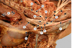 Where is the RIGHT recurrent laryngeal nerve?