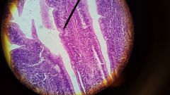 1. Identify this tissue.
2. Find:
- basement membrane
- microvilli
- villus
- goblet cells
- Peyer's Patch
- lumen
- simple columnar epithelium