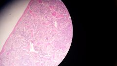 Identify this tissue.

Find:
- capsule
- trabeculae
- red pulp
- white pulp