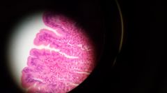 Name this tissue.

Find:
- rugae
- lumen
- gastric pits
- simple columnar epithelium