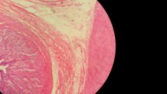 Name this tissue. Identify the three layers.
- mucosal
- submucosal
- muscularis