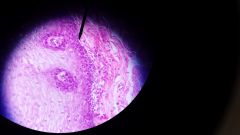 Name this tissue. 
Name the structure the pointer is on.

Identify:
- stratified squamous epithelium
- basement membrane
- lumen