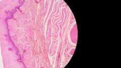 Name this tissue.
Identify:
- stratified squamous epithelium
- basement membrane
- lumen
- 3 layers