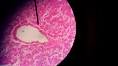 Name this tissue.
Identify:
- hepatocyte
- central vein
- sinusoid