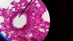 Identify this tissue. Identify the structure the pointer is on.

Identify:
- alveoli
- simple squamous epithelium
- bronchioles