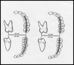 BO line = buccal cusps of mand. 
LO line = lingual cusps of max.
CF line = central fossa of max. or mand.


BO-CF line = mandibular buccal and maxillary CF
LO-CF line = maxillary lingual and mandibular CF