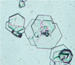 colorless, hexagonal which may be confused with uric acid