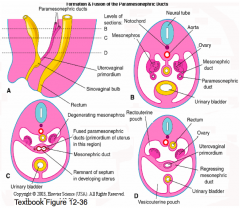 The inferior 1/3 of the paramesonephric ducts fuse together in the midline forming the Uterovaginal Primordium