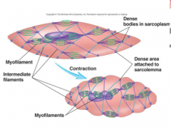 myosins attached to actin are anchored to dense bodies and intermediate filaments. Slower contraction. Have caveolae- indentation sin the sarcolemma which may act as T-tubules.