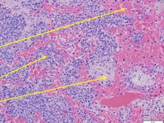 What is indicated by each arrow (different for each)


This is lung tissue