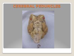 cerebral peduncles