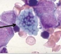Given that these are plasma cells what is the arrow pointing to within the cell?


What does this indicate?