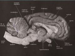 Hypothalamus (Mid sagittal)
