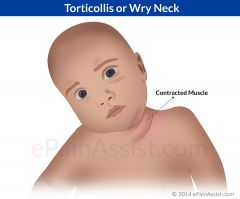 congenital or retropharyngeal abscess (with muffled voice)