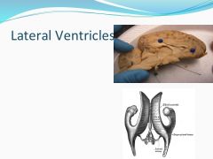 Where are the Lateral ventricles (Mid sagittal)