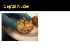 What is the septal nuclei responsible for? What happens if there is damage? Where is it? (Coronal View)