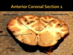 What is the caudate nucleus responsible for? Where is it (Coronal View)