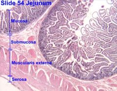 Brunner's glands in the jejunum's submucosa.  note plicae circularis near lumen.
