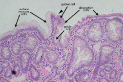 Unlike the stomach, whose surface is covered by a homogenous population of surface mucous (foveolar) cells, the surface epithelium of the intestinal tract shows absorptive cells as well as some number of mucus-secreting goblet cells.