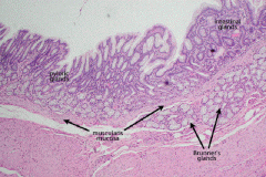 No glands in stomach's submucosa, Brunner's glands do mark the duodenum's submucosa