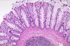 In

					the colon, there are no glands opening in pits but only crypts of Lieberkhün with mostly goblet
cells. The epithelium is mostly covered with goblet cells also                