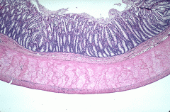 In the colon, there are no glands opening in pits but only crypts of Lieberkhün with mostly goblet cells. The epithelium is mostly covered with goblet cells also                