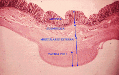 Taenia Coli as a budge on the outside of the colon